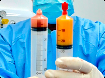 Comparação entre o material coletado e a fração processada